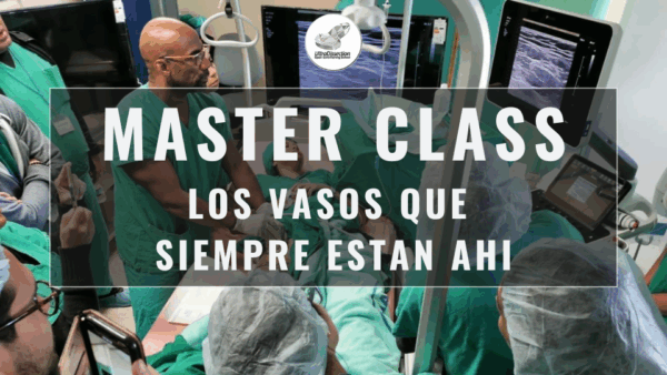 Master Class en video: LOS VASOS QUE SIEMPRE ESTAN AHI