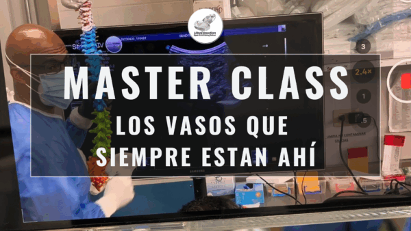 Masterclass 33 | Los vasos que siempre están ahí y que te pueden sorprender