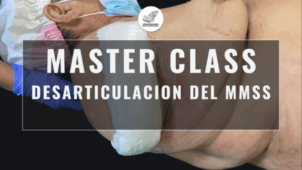 Master Class en video: DESARTICULACION DEL MMSS