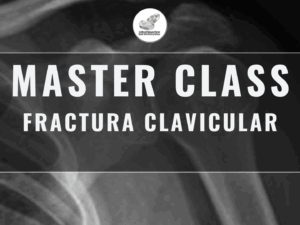 Master Class en video: FRACTURA CLAVICULAR