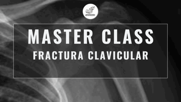 Masterclass 19 | Fractura Clavicular