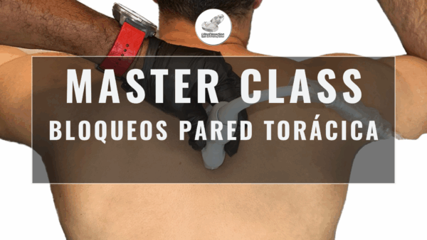 Masterclass 21 | Bloqueos Pared Torácica