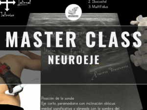 Master Class en video: NEUROEJE